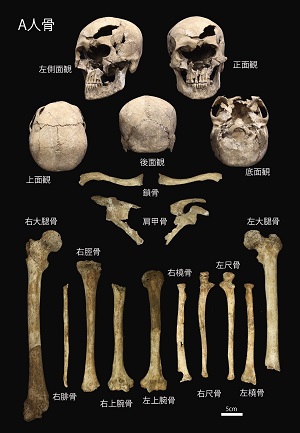 A人骨の頭蓋骨を色々な角度から写した写真や大腿骨、鎖骨、肩甲骨、脛骨、尺骨等の骨の写真